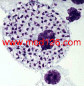 infected_macrophage.gif (31061 ֹ(ji))