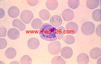 vivax_female_gametocyte.jpg (10769 ֹ(ji))